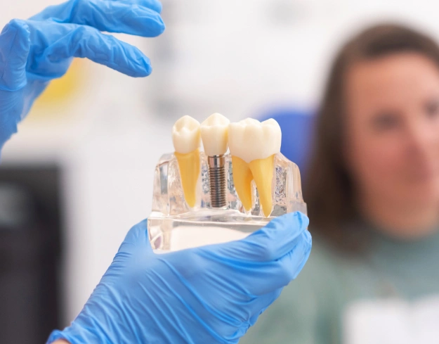 Dentist in blue gloves holding clear dental model showing tooth structure and dental work samples.