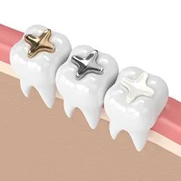 Three white tooth models with gold, silver, and clear cross-shaped dental crowns on pink gum background.